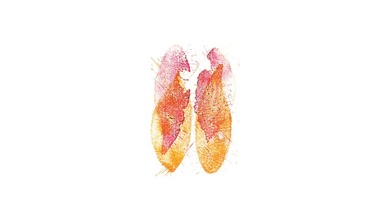 Leaf print in the hues of yellow, orange and pink.
